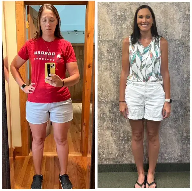 Amber D. before and after