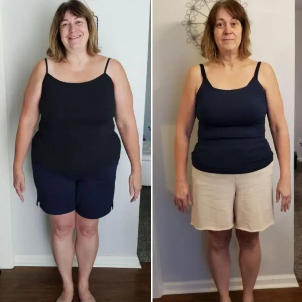 Michelle F. before and after
