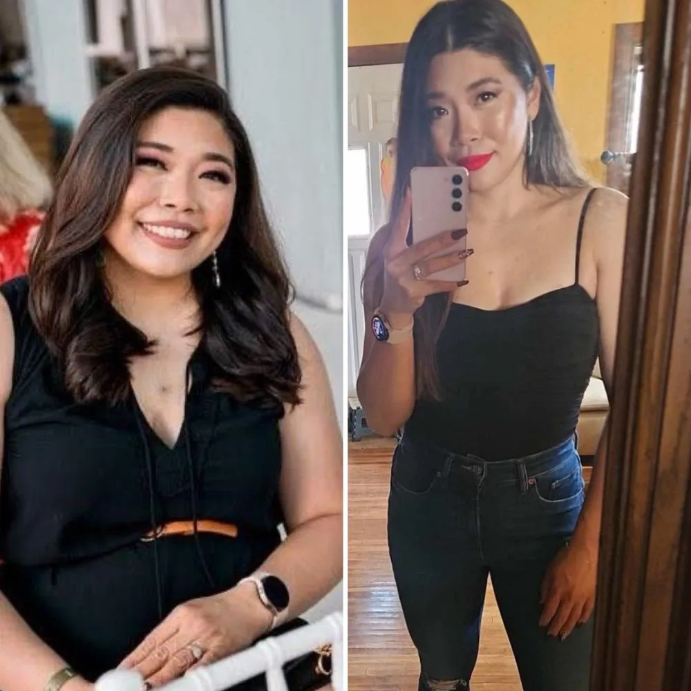 Natalie before and after
