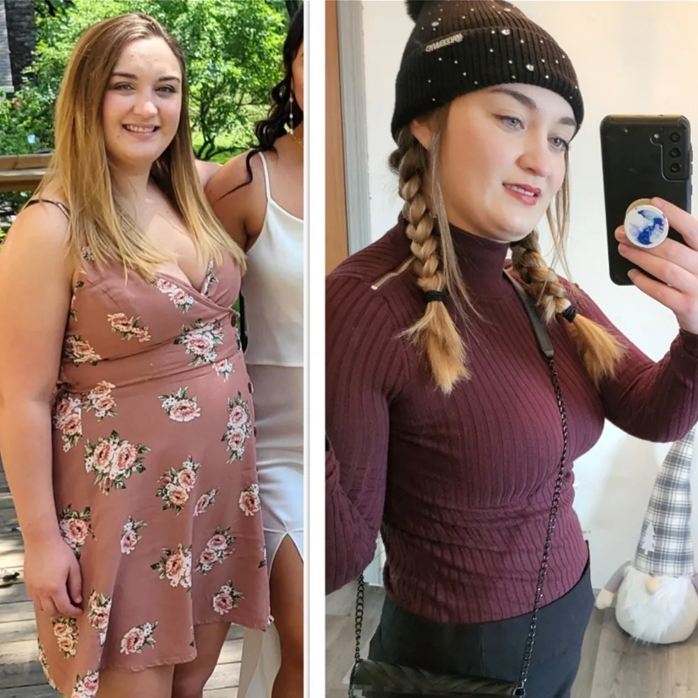 Stephanie, RN before and after